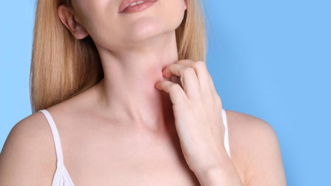 Alergia la căldură (miliaria): Cum recunoști iritația și ce măsuri să iei pentru a o preveni și trata Alergia la căldură (miliaria): Cum recunoști iritația și ce măsuri să iei pentru a o preveni și trata