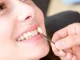 Cât rezistă fațetele dentare și de ce factori depinde durabilitatea lor