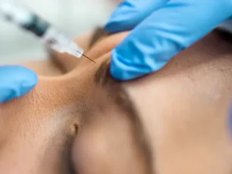 Ce tratamente estetice poți face înainte de sărbători fără să ai nevoie de timp de recuperare