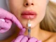 4 lucruri surprinzătoare despre injecțiile pentru buze: ce ar trebui să știi înainte de procedură