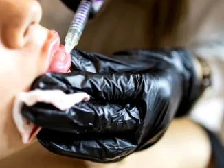 Trend îngrijorător în rândul adolescentelor: intervențiile estetice tot mai devreme. Avertismentul medicilor