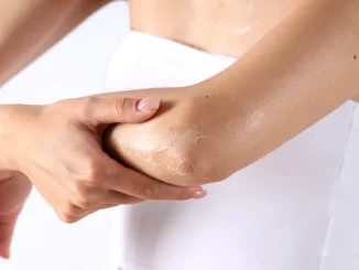 De ce apare pielea aspră pe brațe și picioare