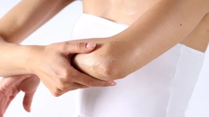 De ce apare pielea aspră pe brațe și picioare