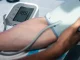 Tensiunea peste 14 nu trebuie ignorată. Ce riscuri ascunde hipertensiunea arterială